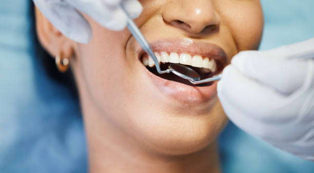 Best Emergency Denture Repair in Drew, MS